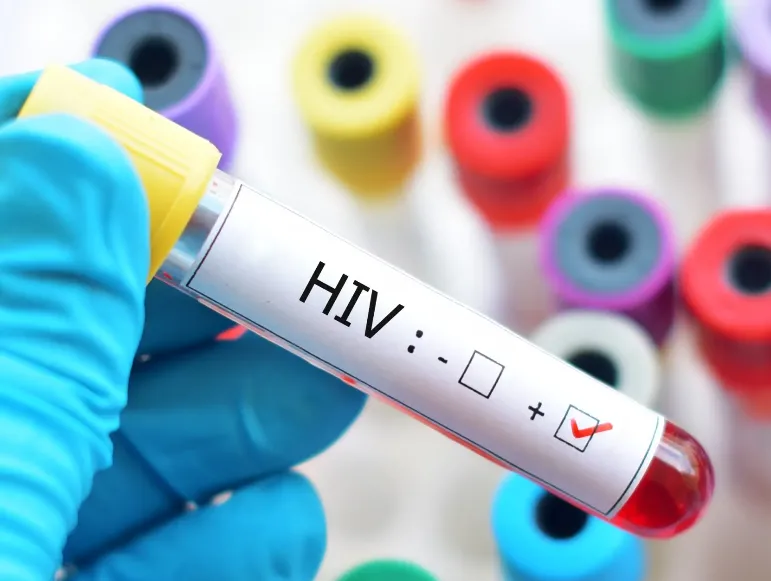 斐济HIV疫情全球增长最快 新西兰公共卫生面临威胁